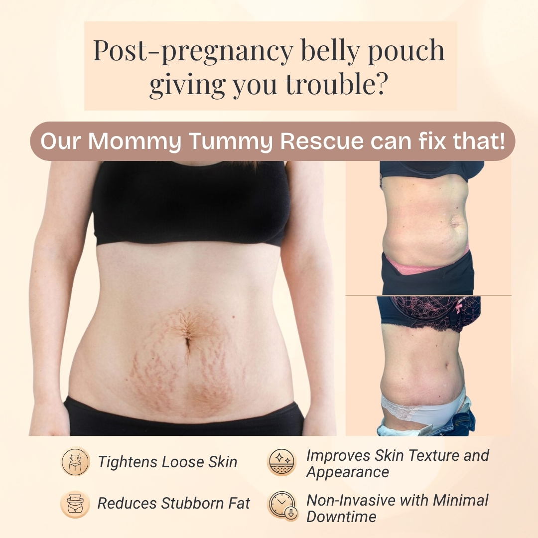 I Love Skin Treatments Facebook ad