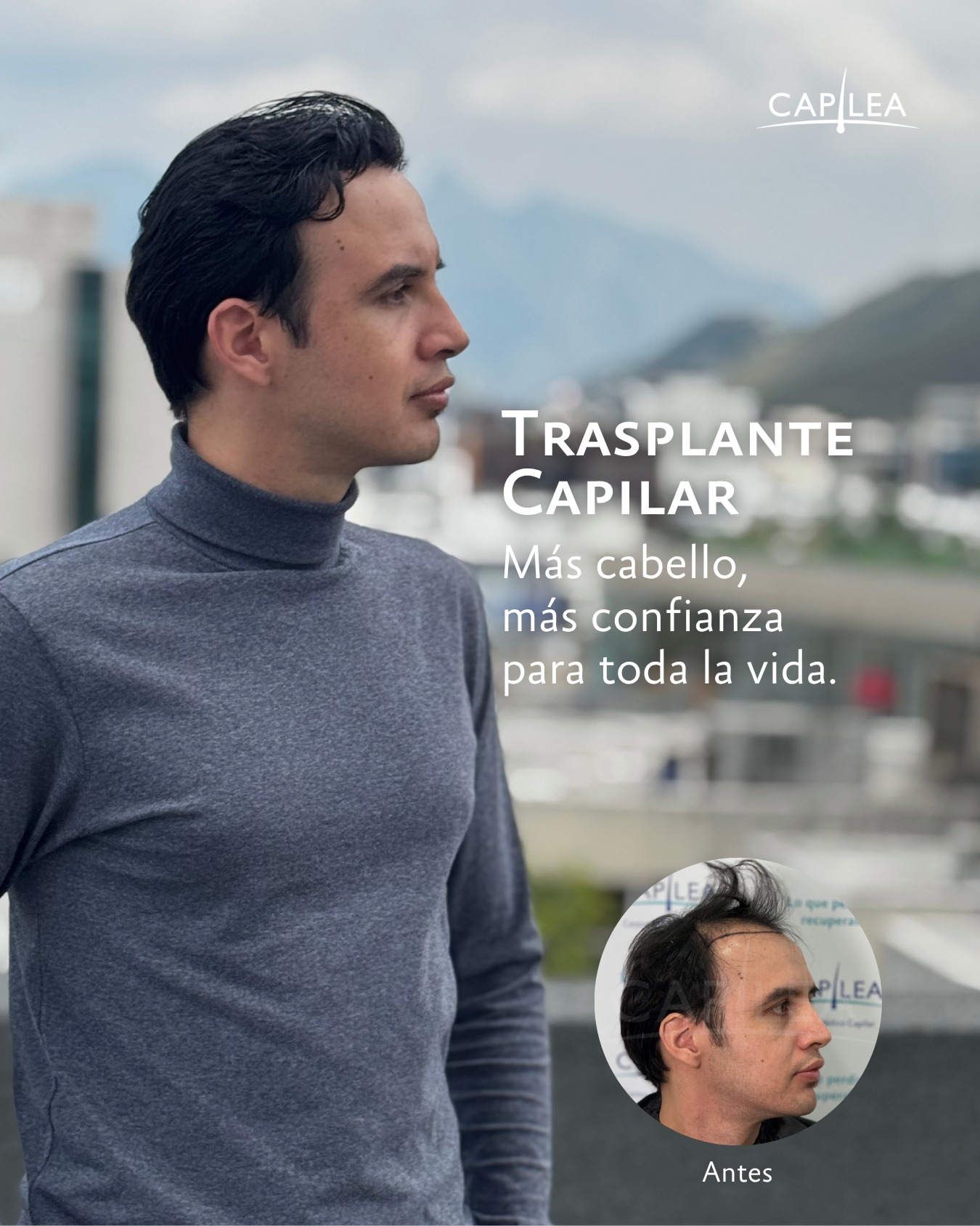 Capilea México Facebook ad