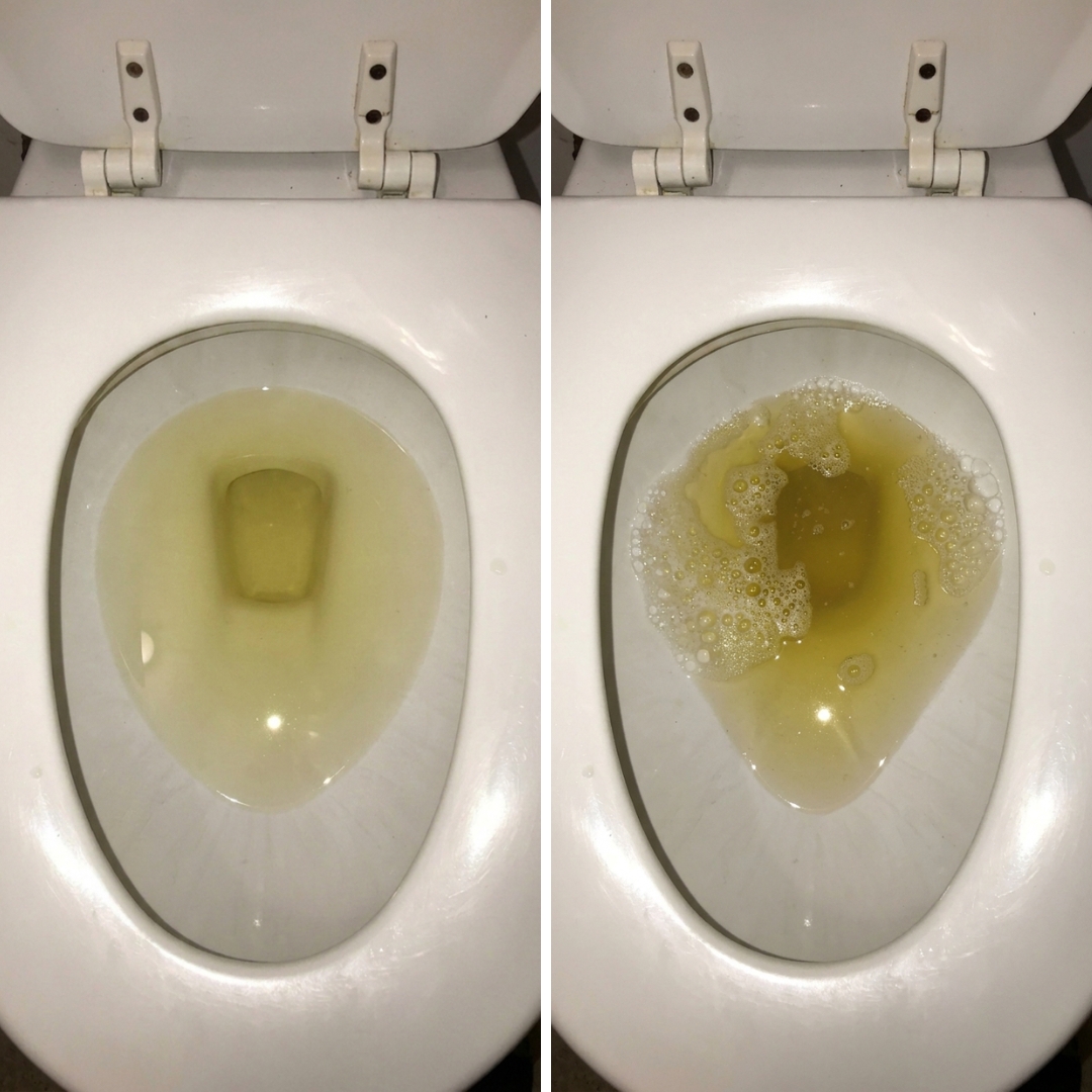 Sandra Keller, RN Facebook ad