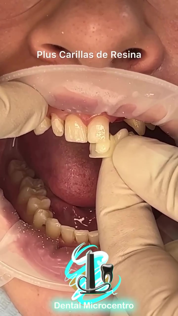 Dental Microcentro Facebook ad: Dental Ciudad Clínica Odontológica con Sede en Microcentro…