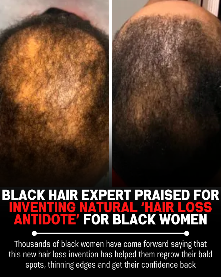 Black Hair Growth Remedy Facebook ad