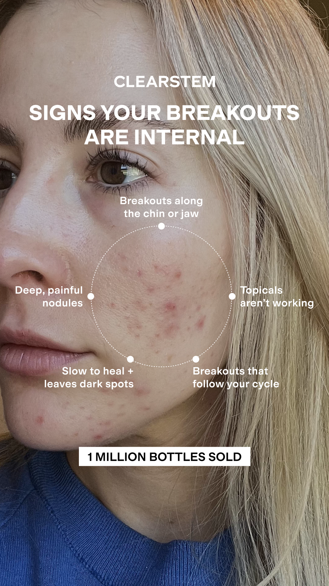 CLEARSTEM Skincare Facebook ad