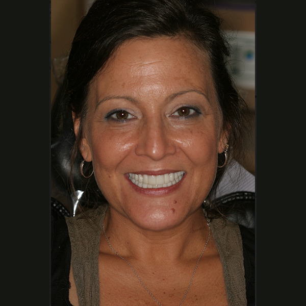 Chandler Park Dental Care Facebook ad: Bowling Green's Premier Implant Center