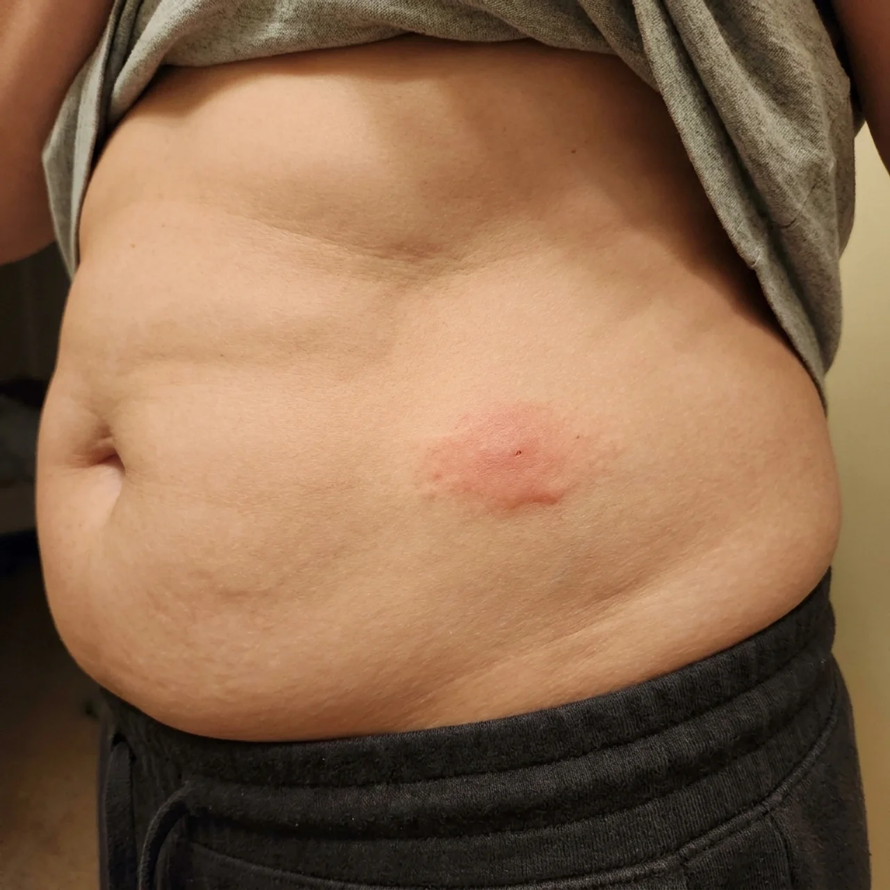Dr. Jacob Kinson Facebook ad: GHK-Cu Without The Risky Injections