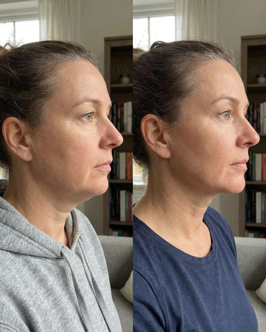 Mimika - Face Yoga Exercises Facebook ad