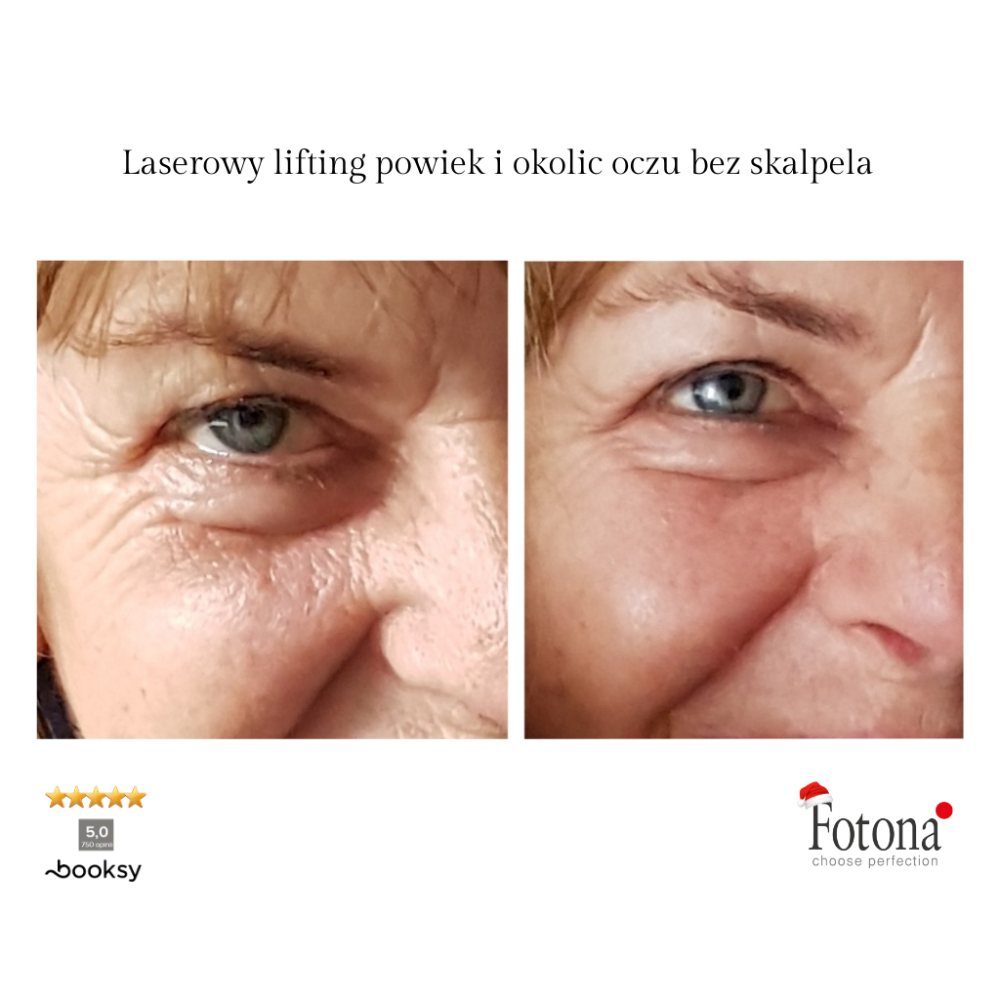 BeautyPark Solvay Facebook ad