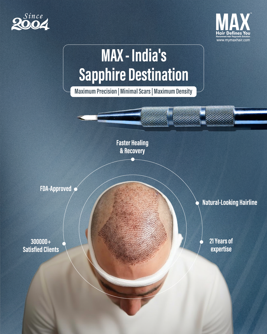 MAX Hair Clinic Facebook ad