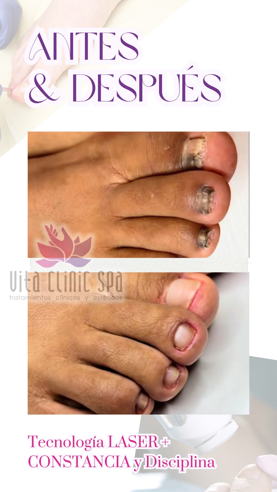 Spa Vita clínic Facebook ad: 20 años intentando de todo.