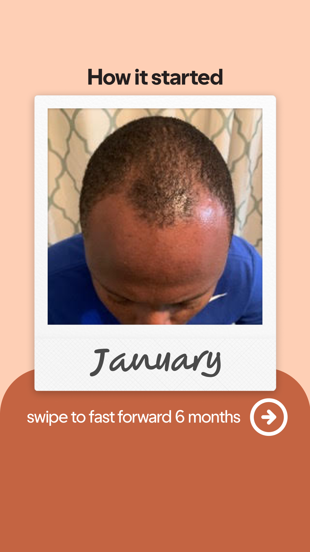 hims Facebook ad