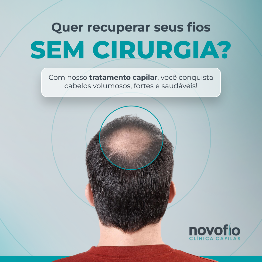 Novofio Clínica Capilar Salvador - Itaigara Facebook ad: Avaliação personalizada