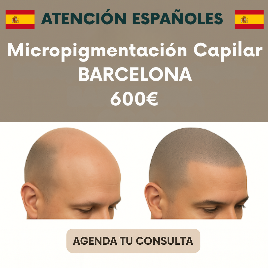 Andrés Moreno Micropigmentación Facebook ad: Micropigmentación capilar a solo 600€