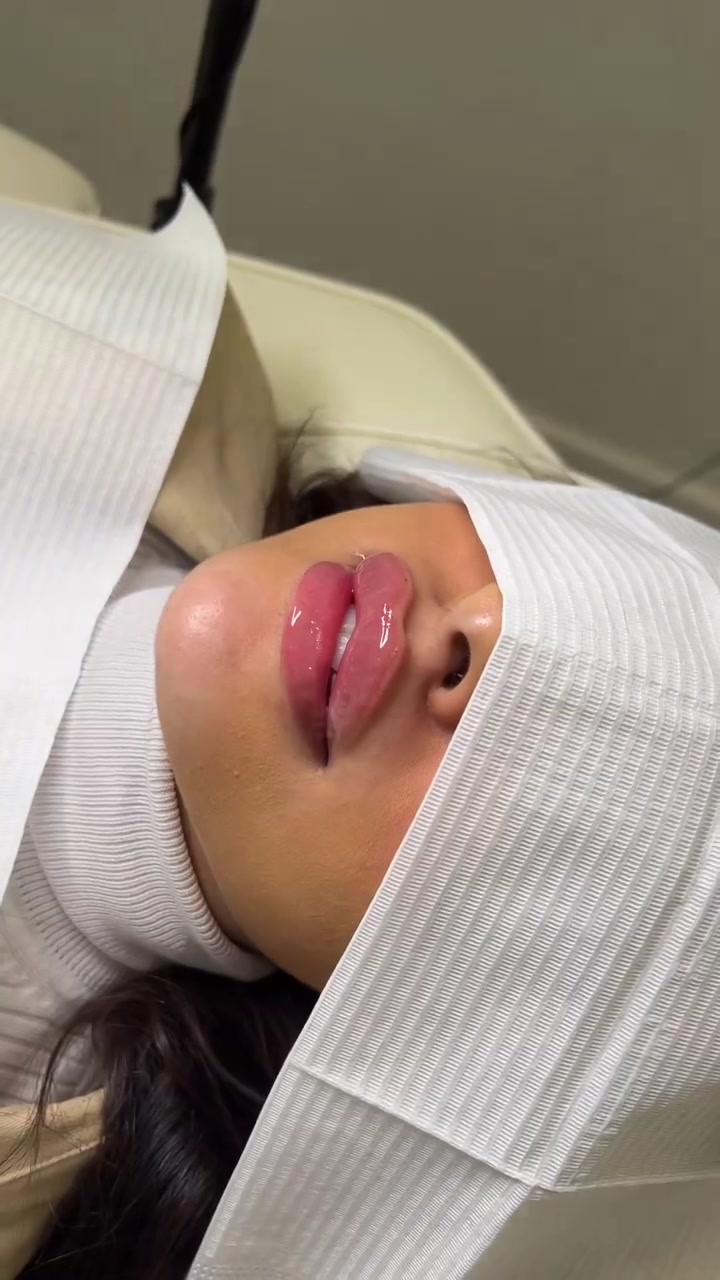 Joanna Injects Facebook ad: *100 OFF** Perfectly Plump