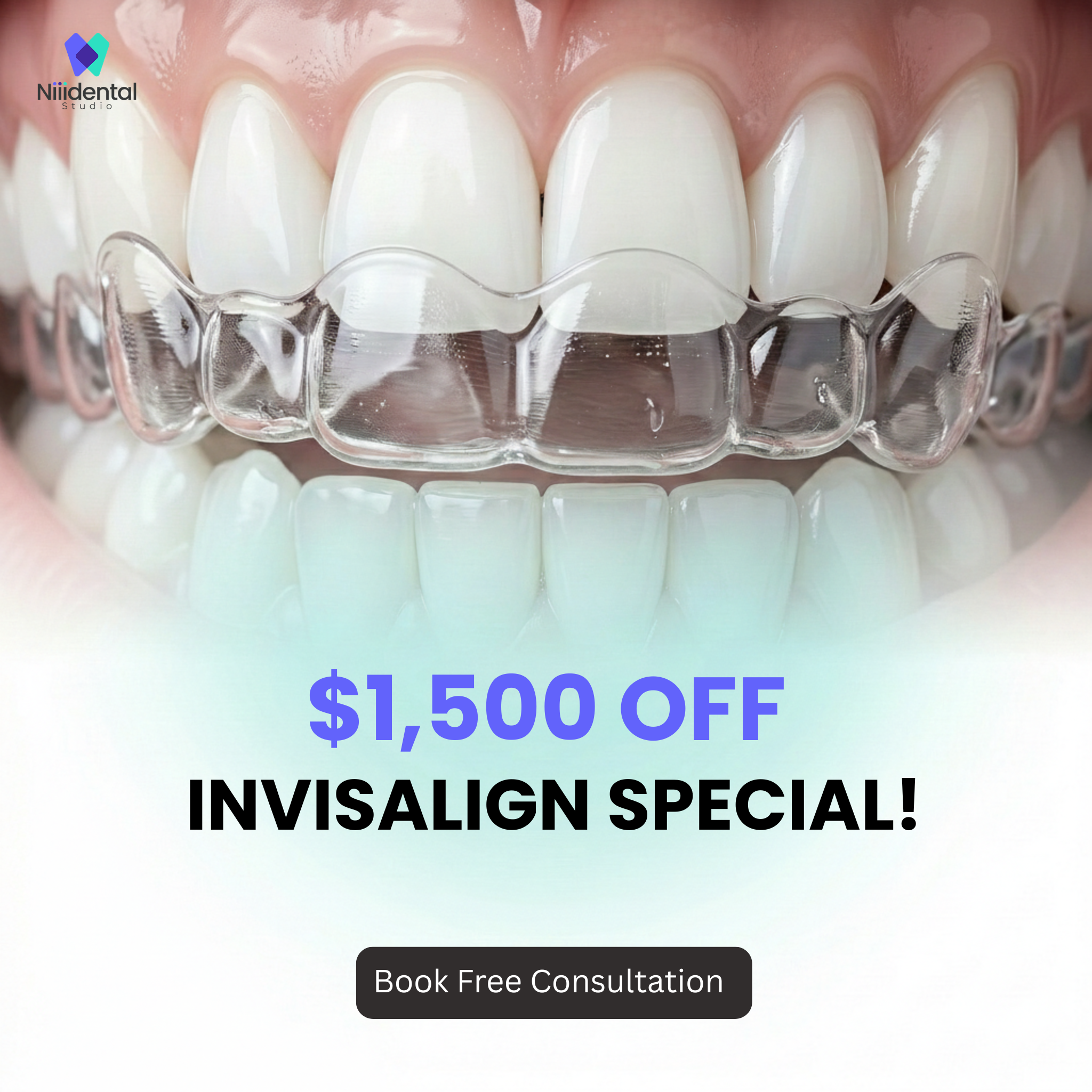 Niiidental Studio Facebook ad: Hey McKinney! Spring Special $1500 OFF Invisalign Treatment!