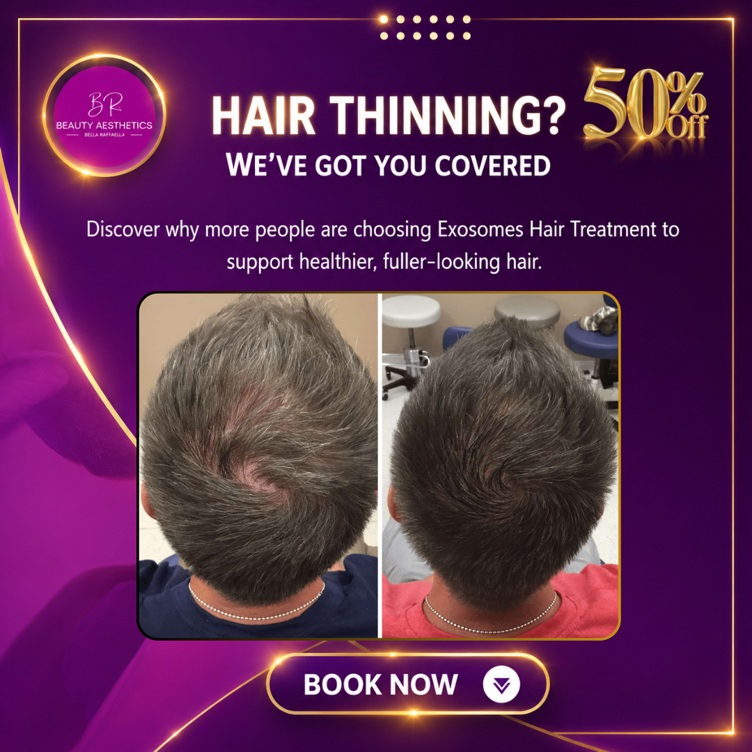 BR Beauty Aesthetics Facebook ad: 50% OFF | Advanced Hair Exosome Therapy