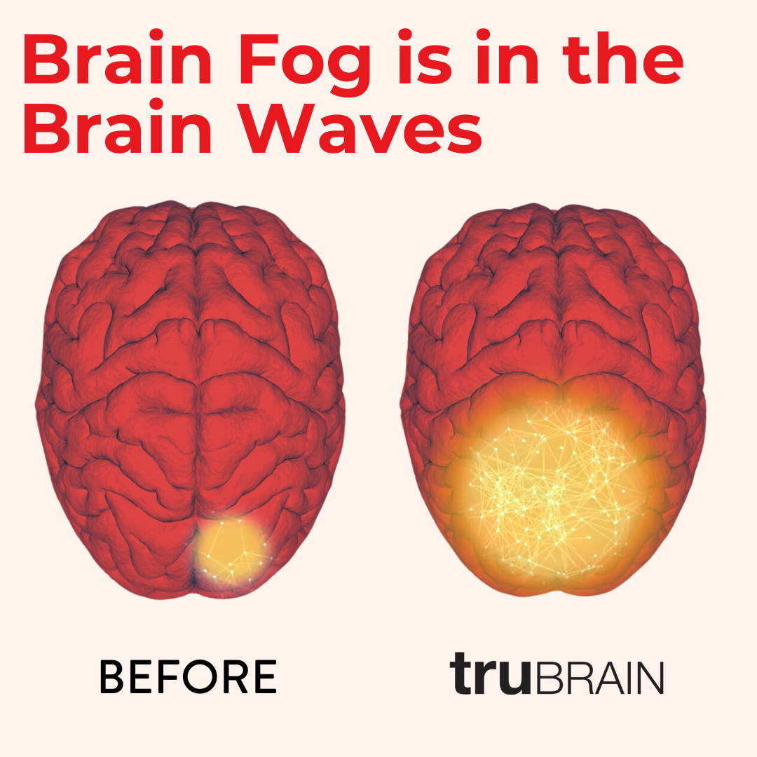 TruBrain Facebook ad
