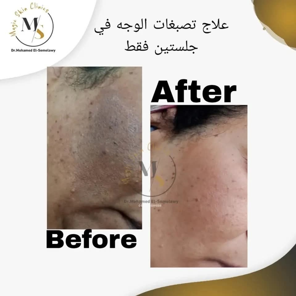 Magic skin clinics Facebook ad
