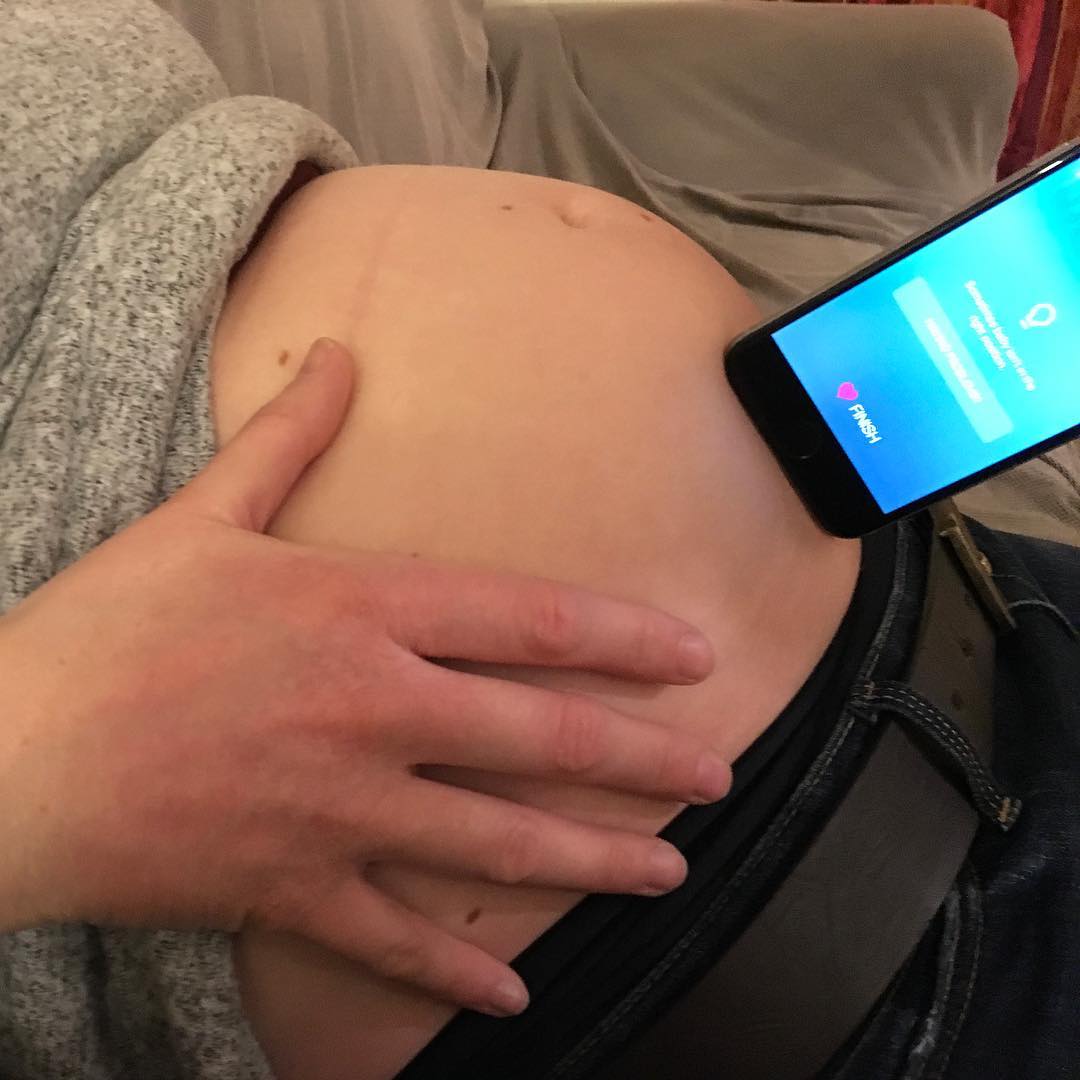 Hear My Baby - Heartbeat Monitor Pregnancy App Facebook ad from Mar 1, 2026