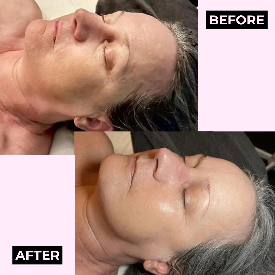 Timeless Spa Center - Chattanooga, TN Facebook ad