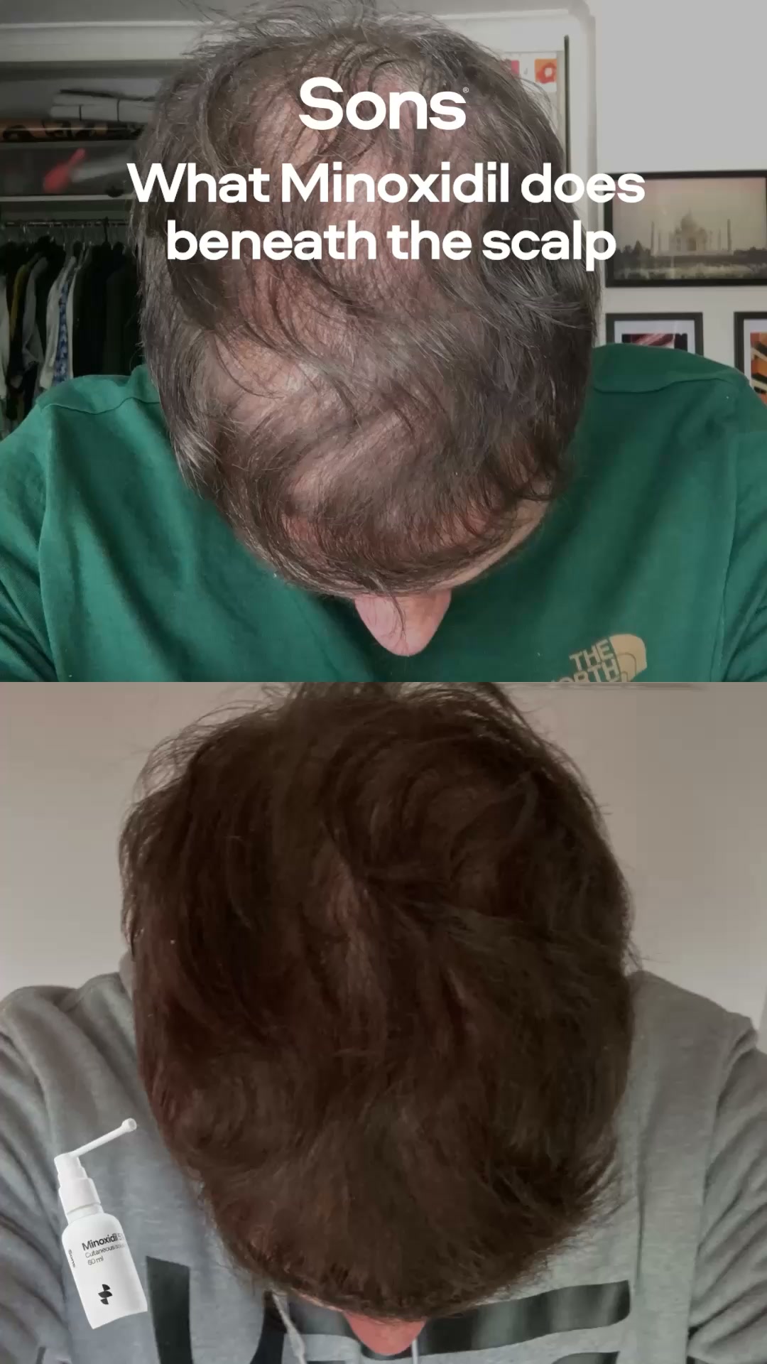 Sons Facebook ad: Your hairline. Your call.