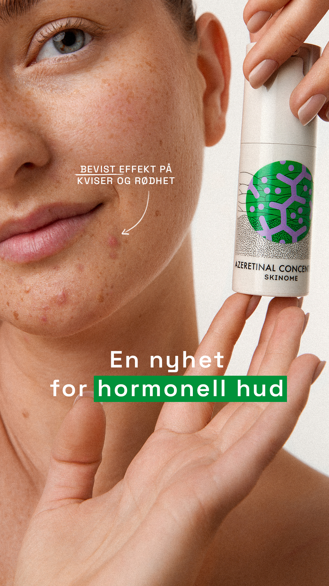Skinome Facebook ad