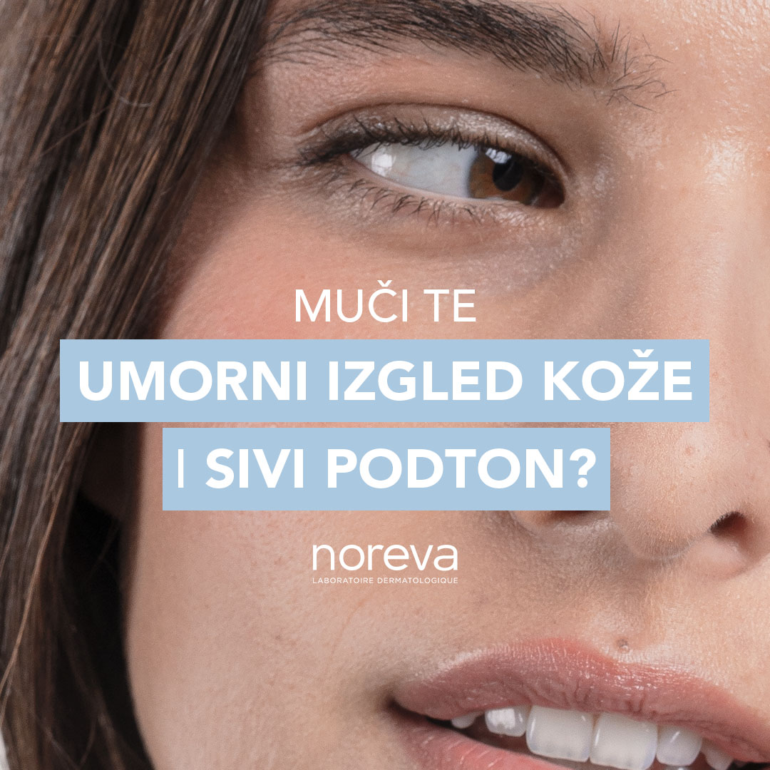 Noreva Srbija Facebook ad
