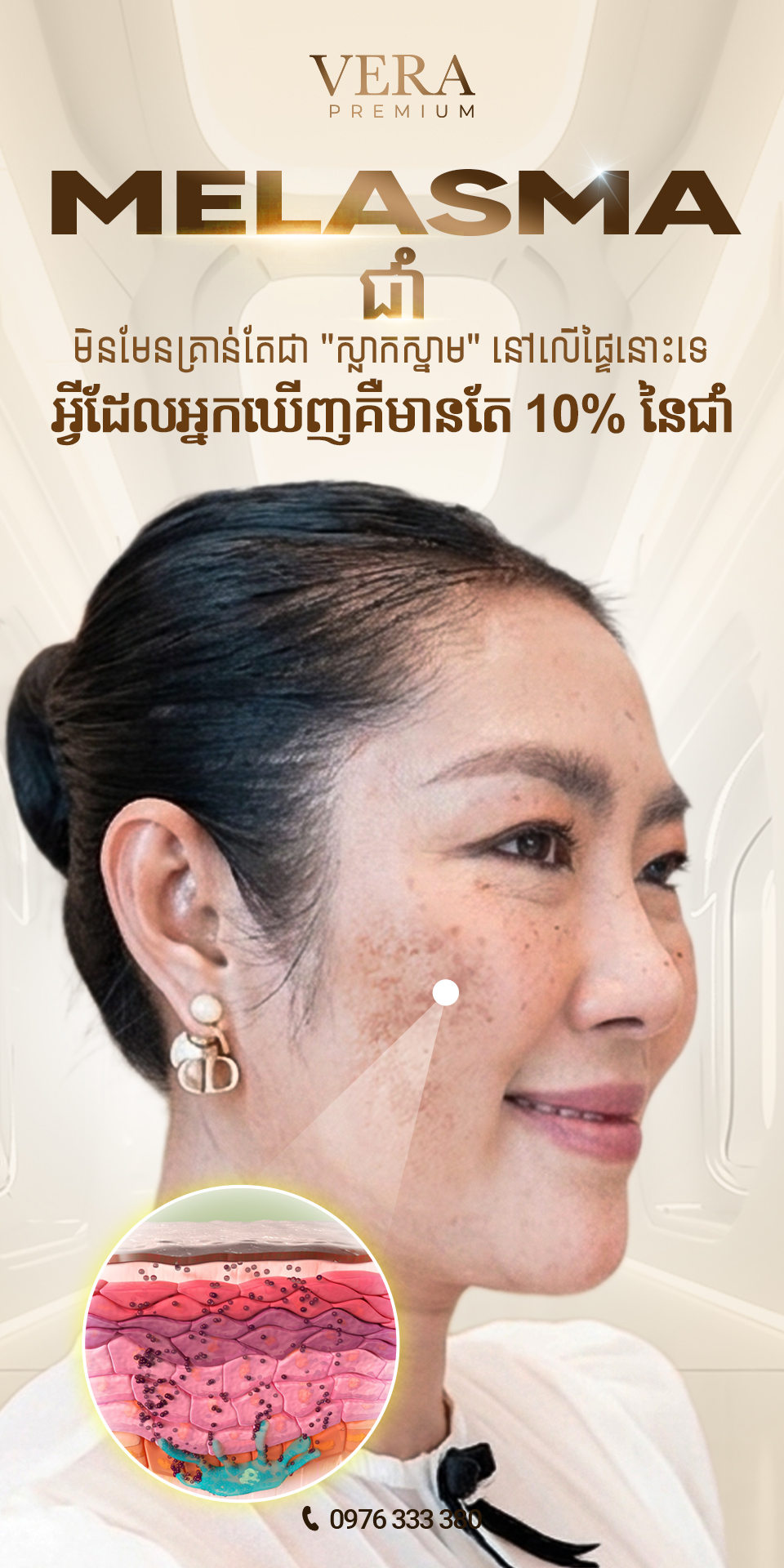 Vera Premium - Vera ព្រីមៀម Facebook ad: (English below) ជាំមិនមែនគ្រាន់តែជា ស្លាកស្នាម…