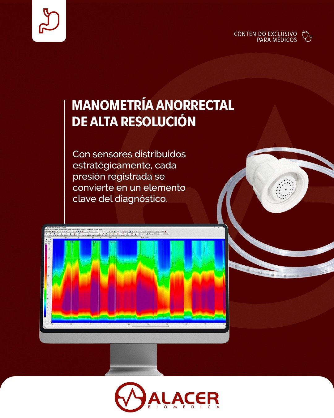 Alacer International Facebook ad: Equipo para Manometría Anorectal de Alta resolución…