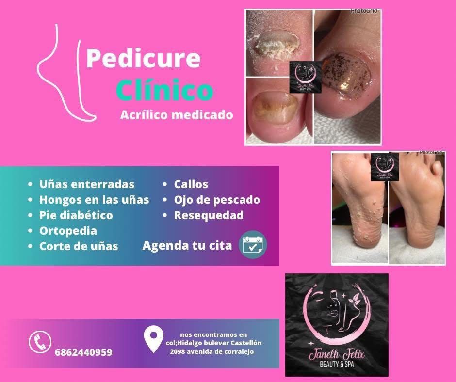 Janeth spa Facebook ad: Agenda tu cita