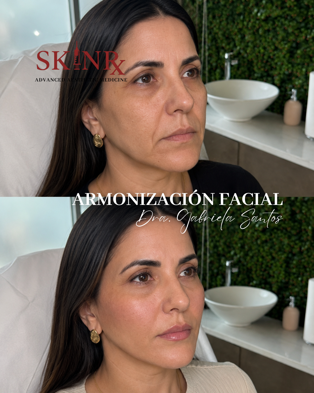 Skin Rx Hn Facebook ad: El objetivo del rejuvenecimiento facial no es cambiar…