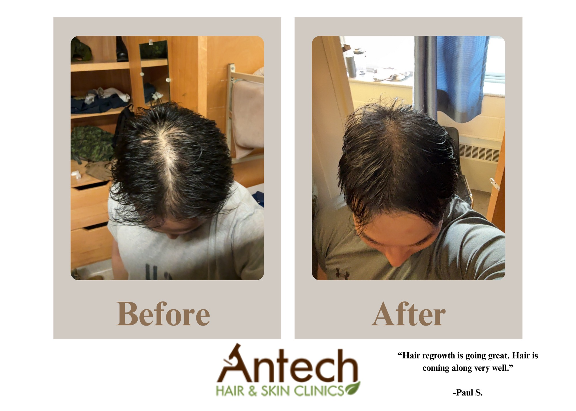 Antech Hair & Skin Clinic Facebook ad