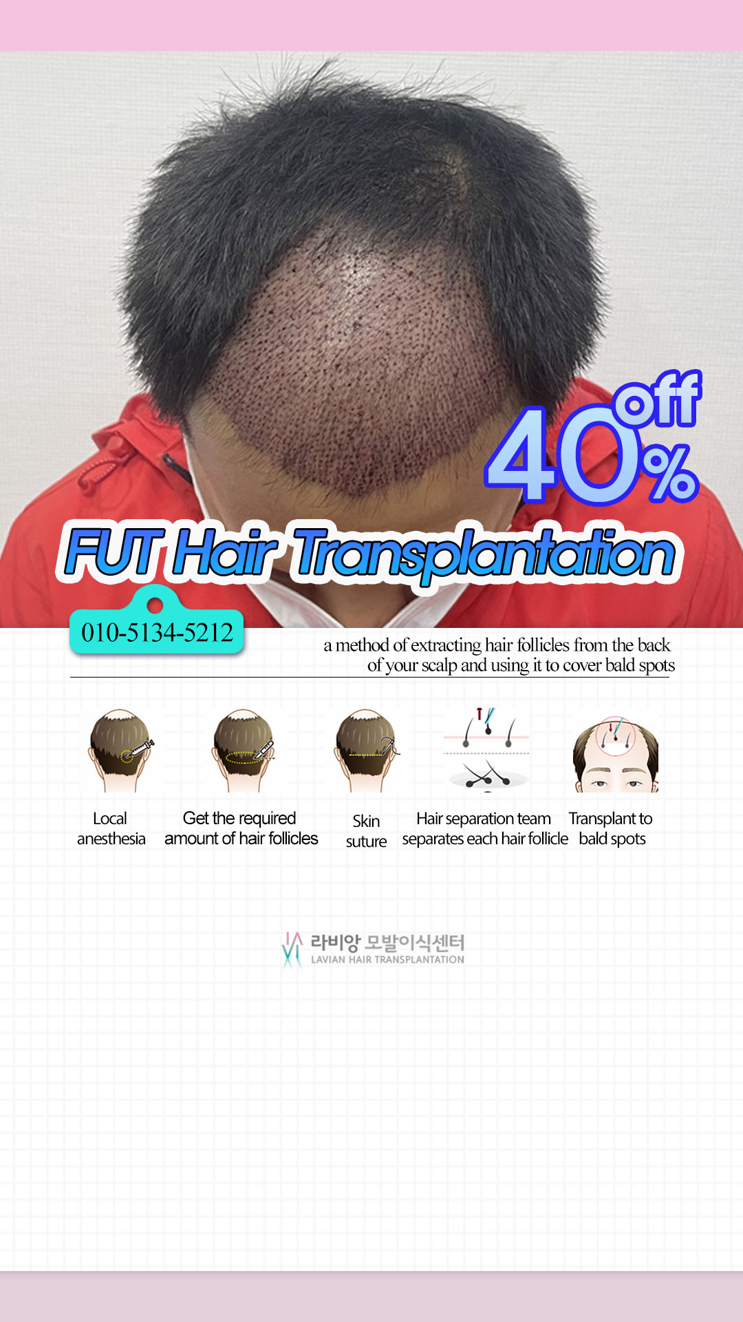Lavian Aesthetic Plastic Surgery Facebook ad from Aug 18, 2025