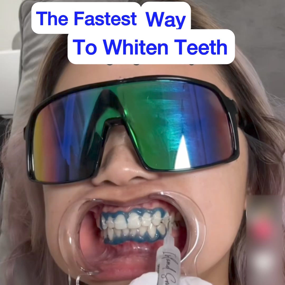 White Smile Facebook ad