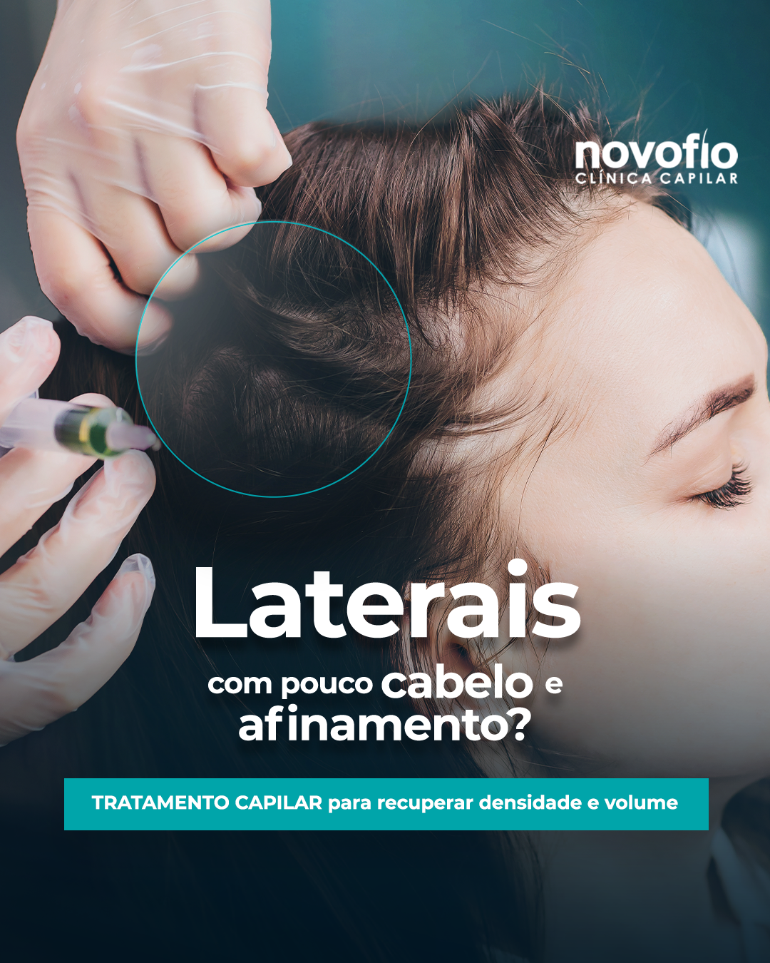 Novofio Belo Horizonte Clinica Capilar Facebook ad