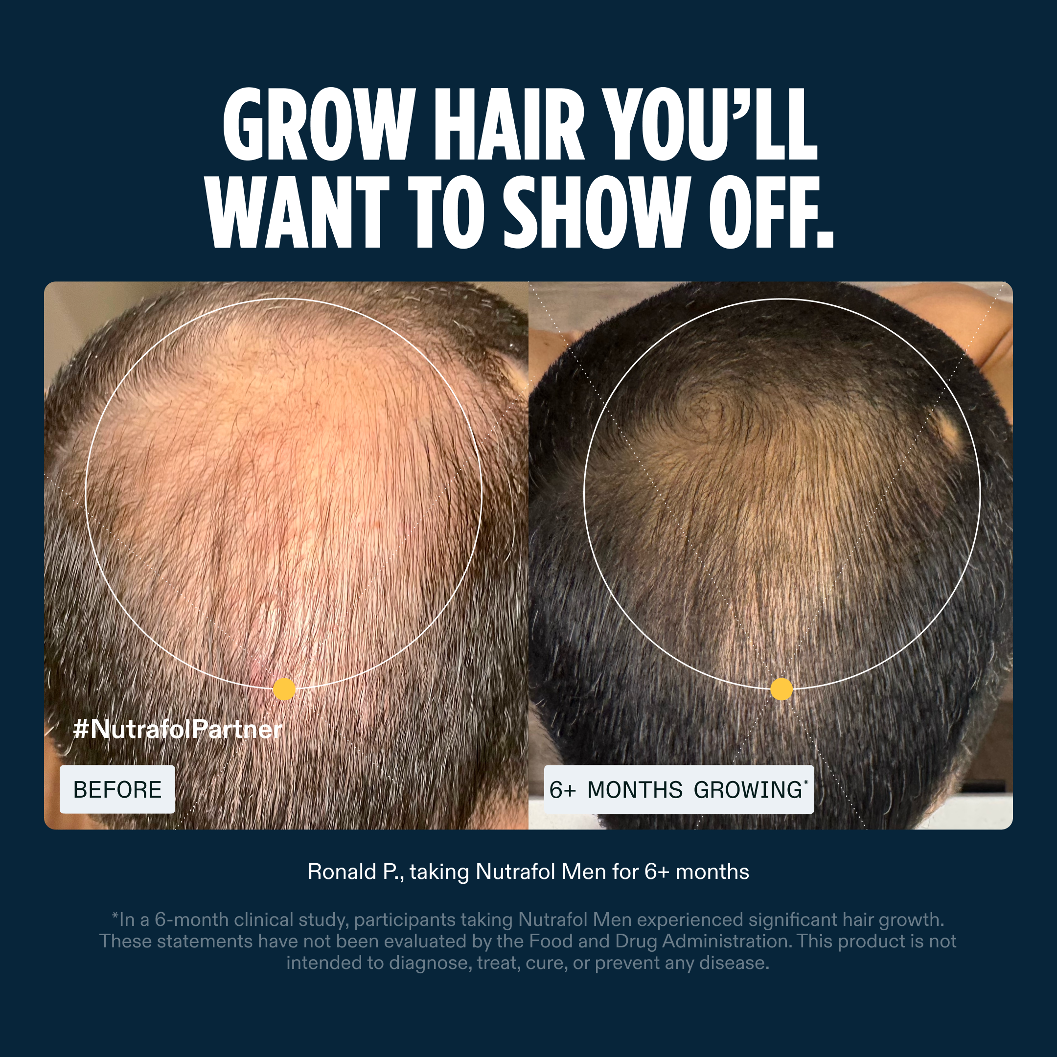 Nutrafol Men Facebook ad