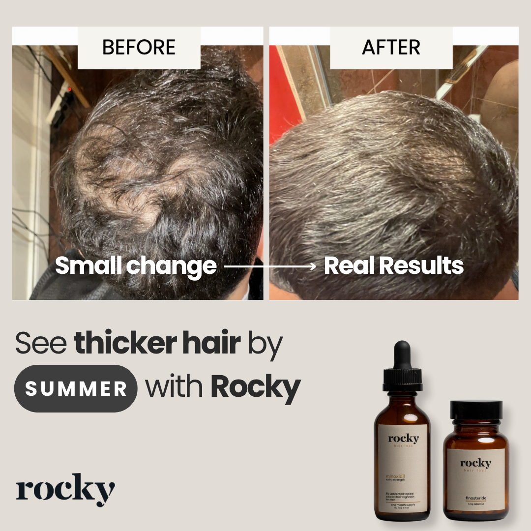 MyRocky Facebook ad