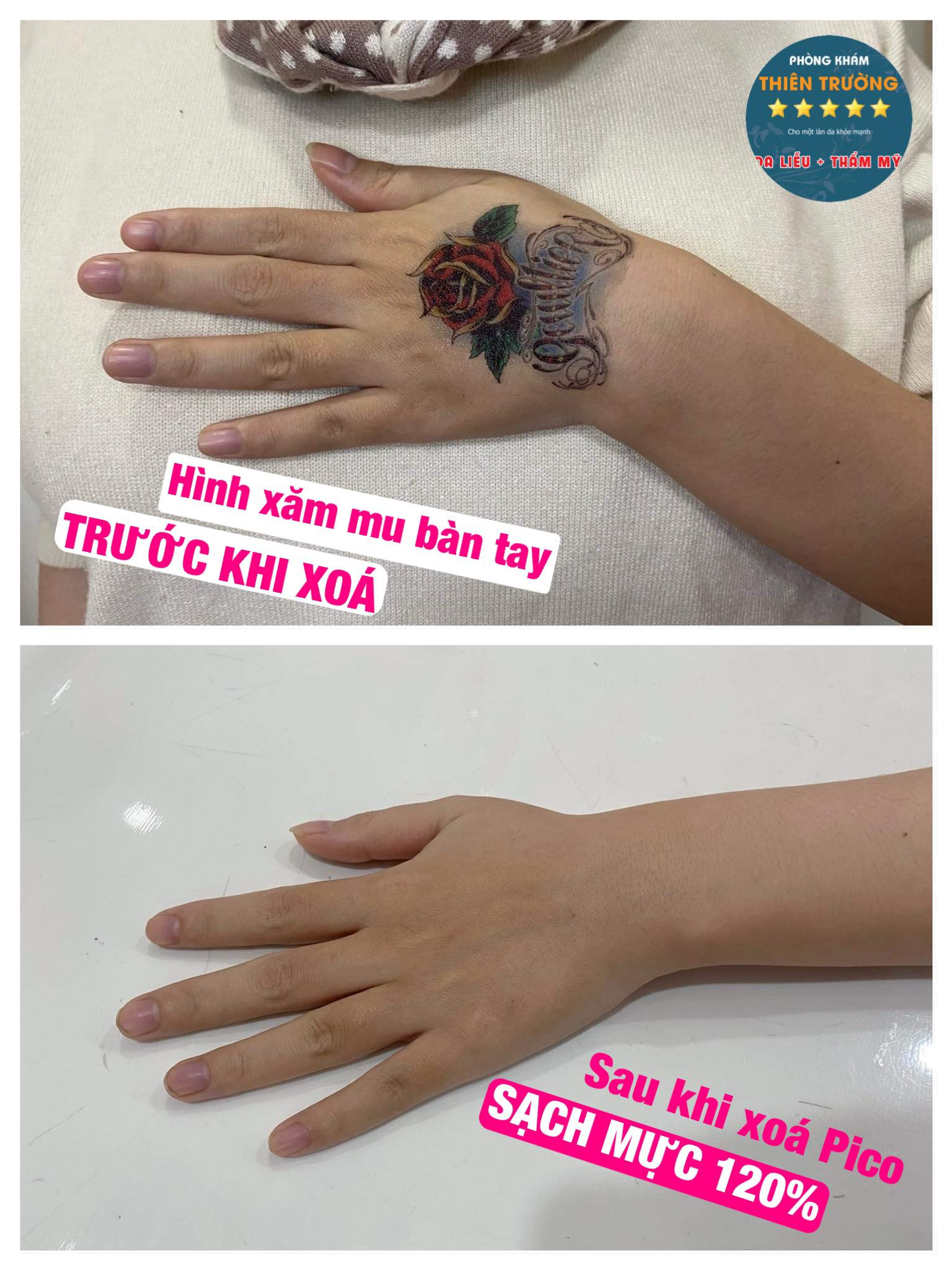 Phòng khám Da liễu - Thẩm mỹ Thiên Trường Facebook ad