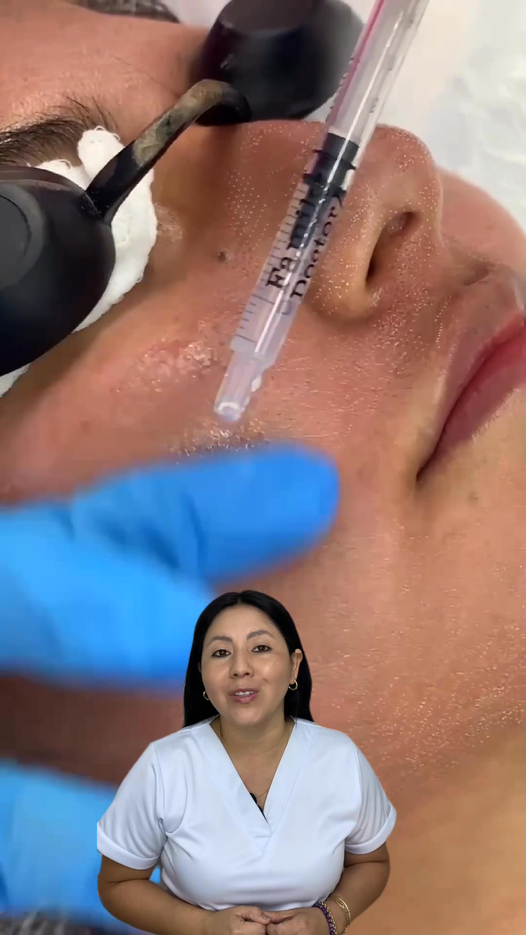 Dermatología Perú - Dra. Jackelyn Montero Facebook ad: SECUELAS DE ACNÉ