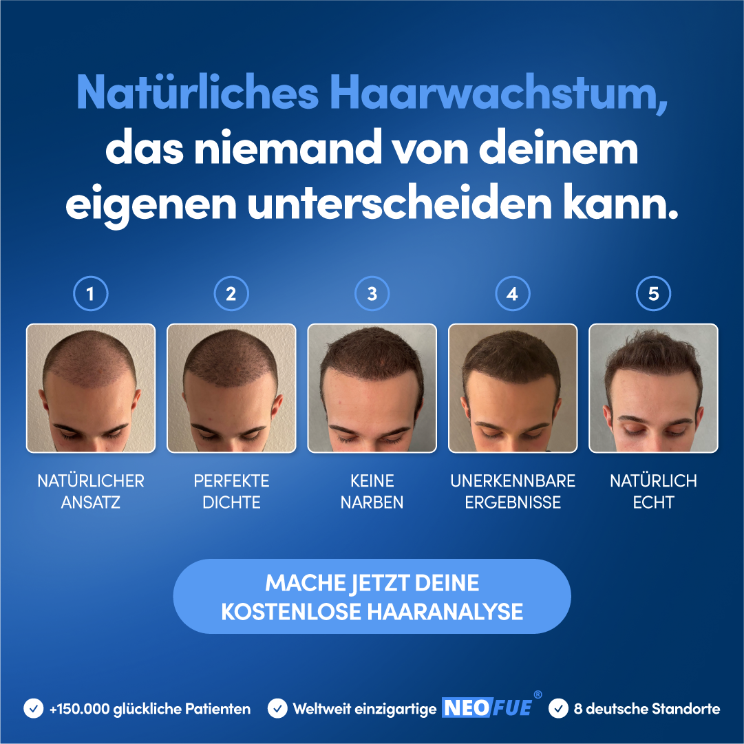 Elithair Facebook ad: Jetzt kostenlose Haaranalyse
