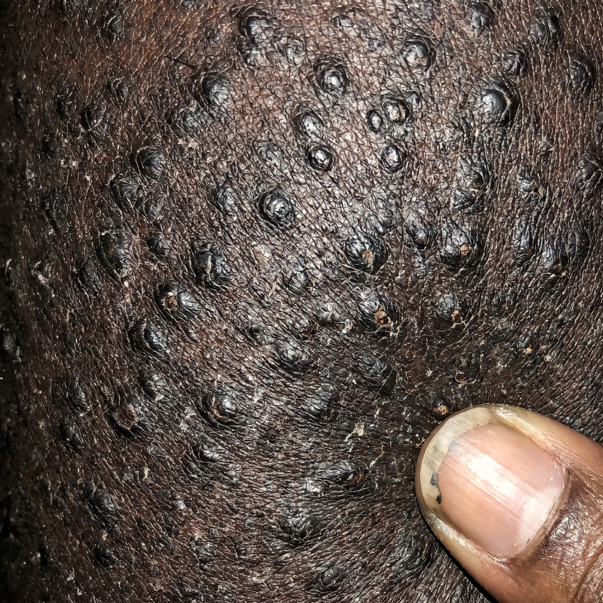 Brianna Harris Facebook ad: URGENT WARNING Stop scrubbing your legs if they look like…