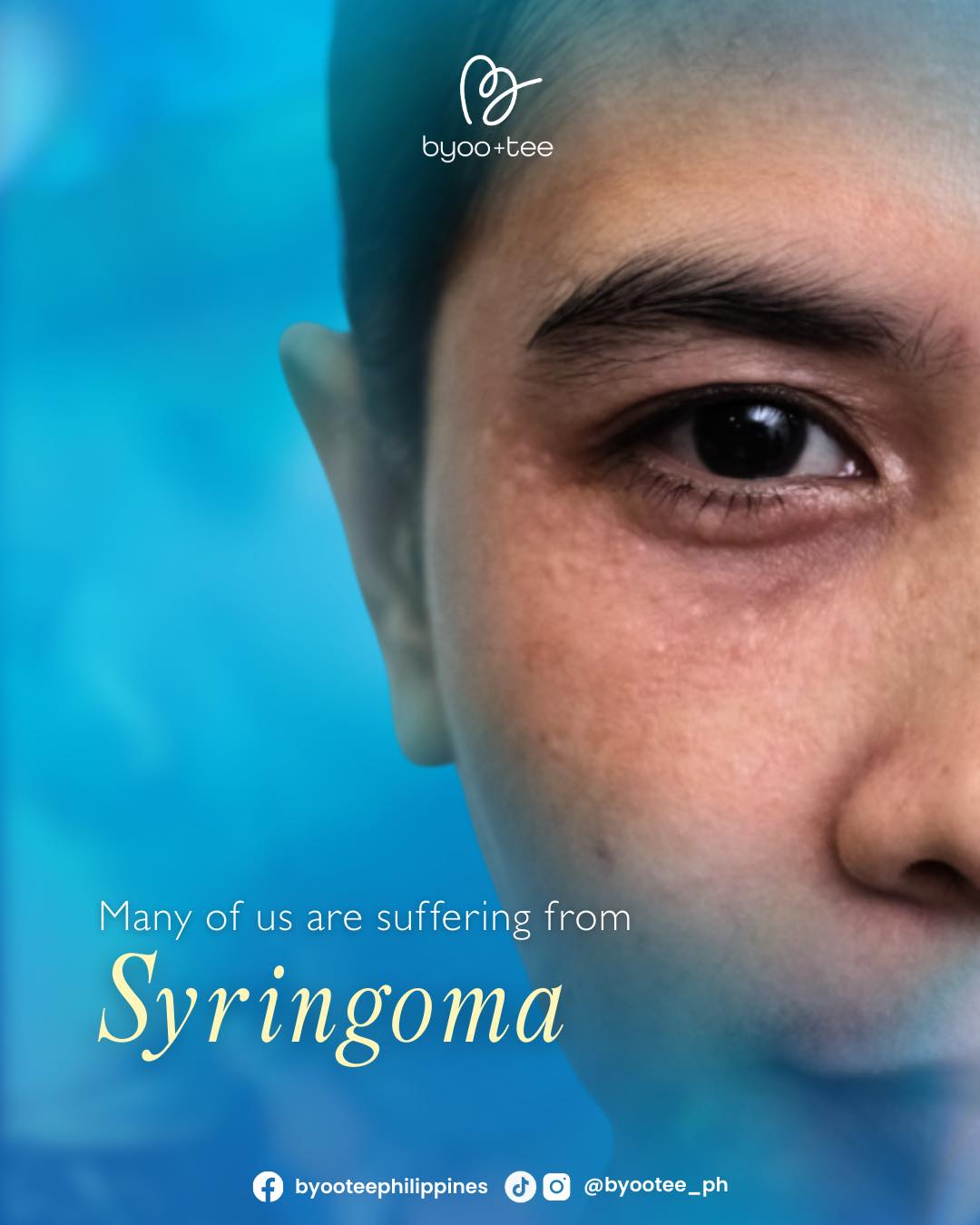 Byootee Aesthetic Lounge Facebook ad: Struggling with syringoma, double chin, dark circles, or…