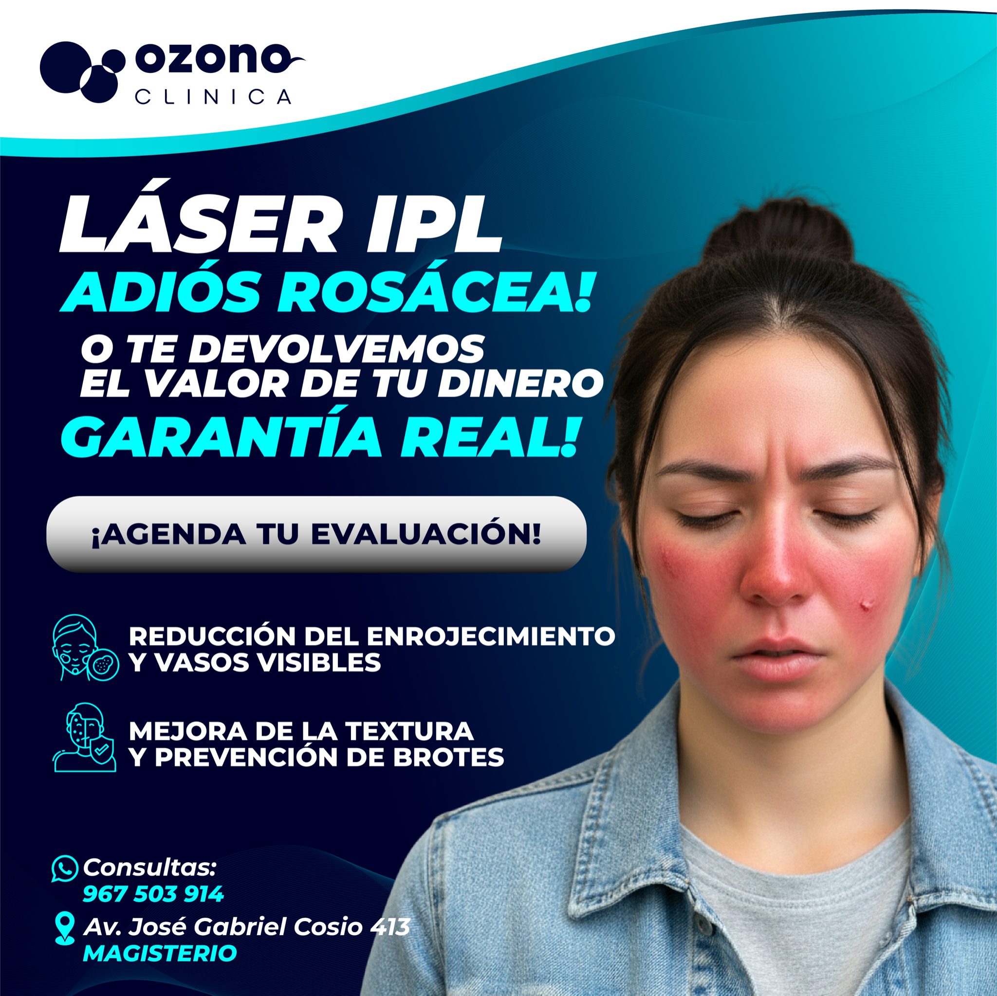 Ozonolaser Facebook ad: SI NO TRATAS la rosácea