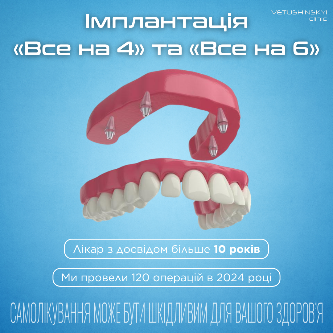Vetushinskyi Clinic Стоматологія Ветушинського Facebook ad: VETUSHINSKYI clinic