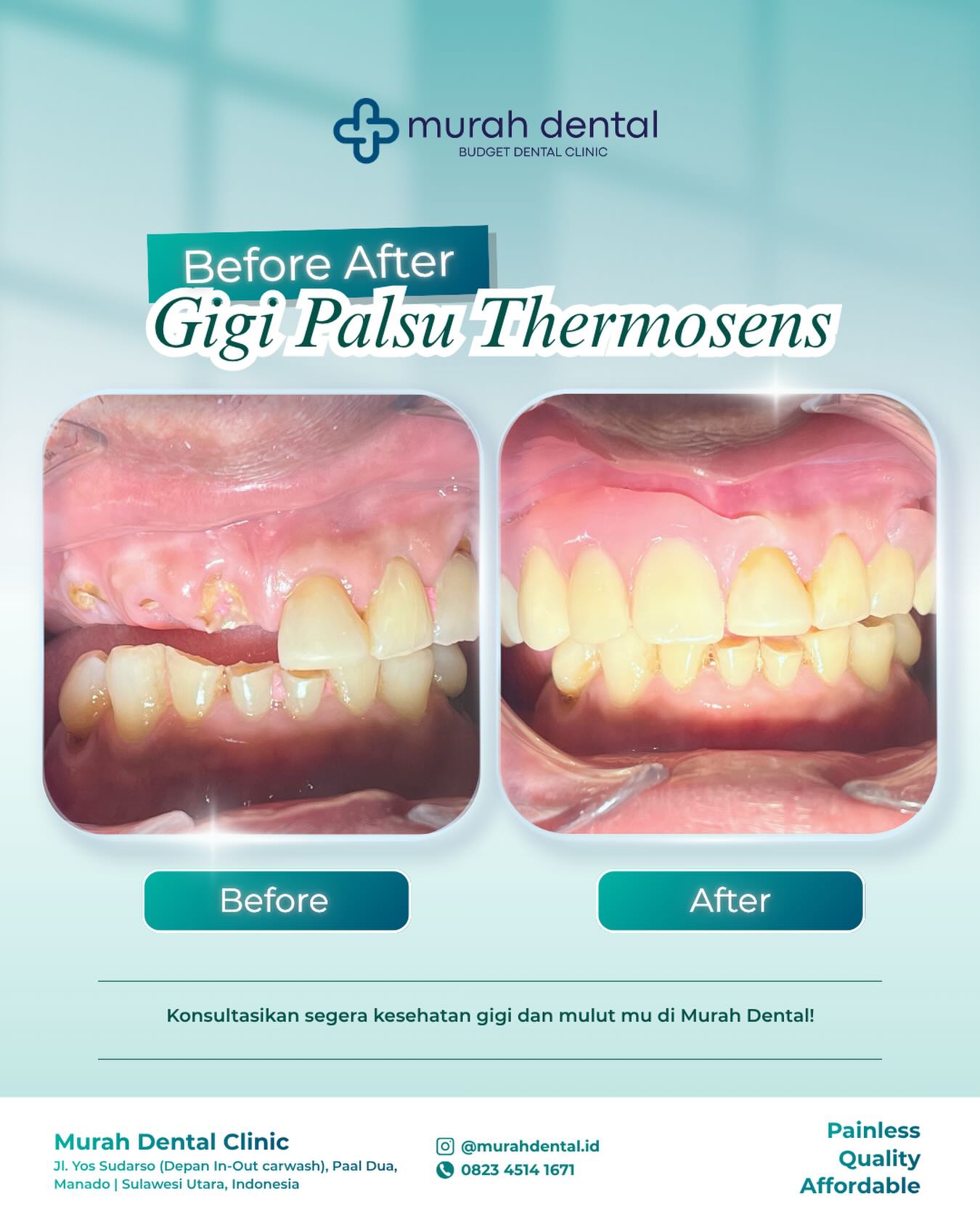 Murah Dental Facebook ad: Saya pikir gigi palsu itu pasti tidak nyaman…