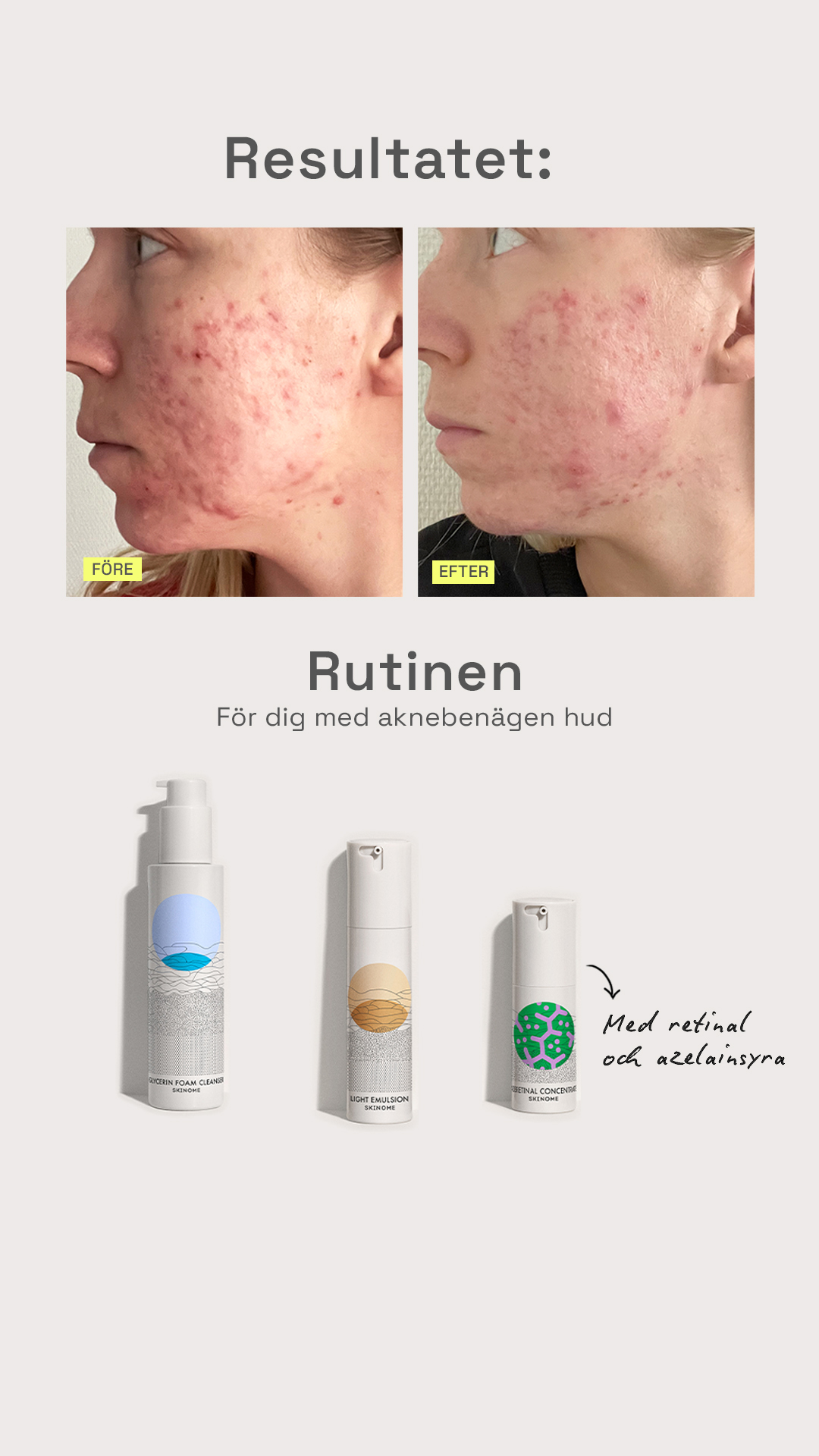 Skinome Facebook ad