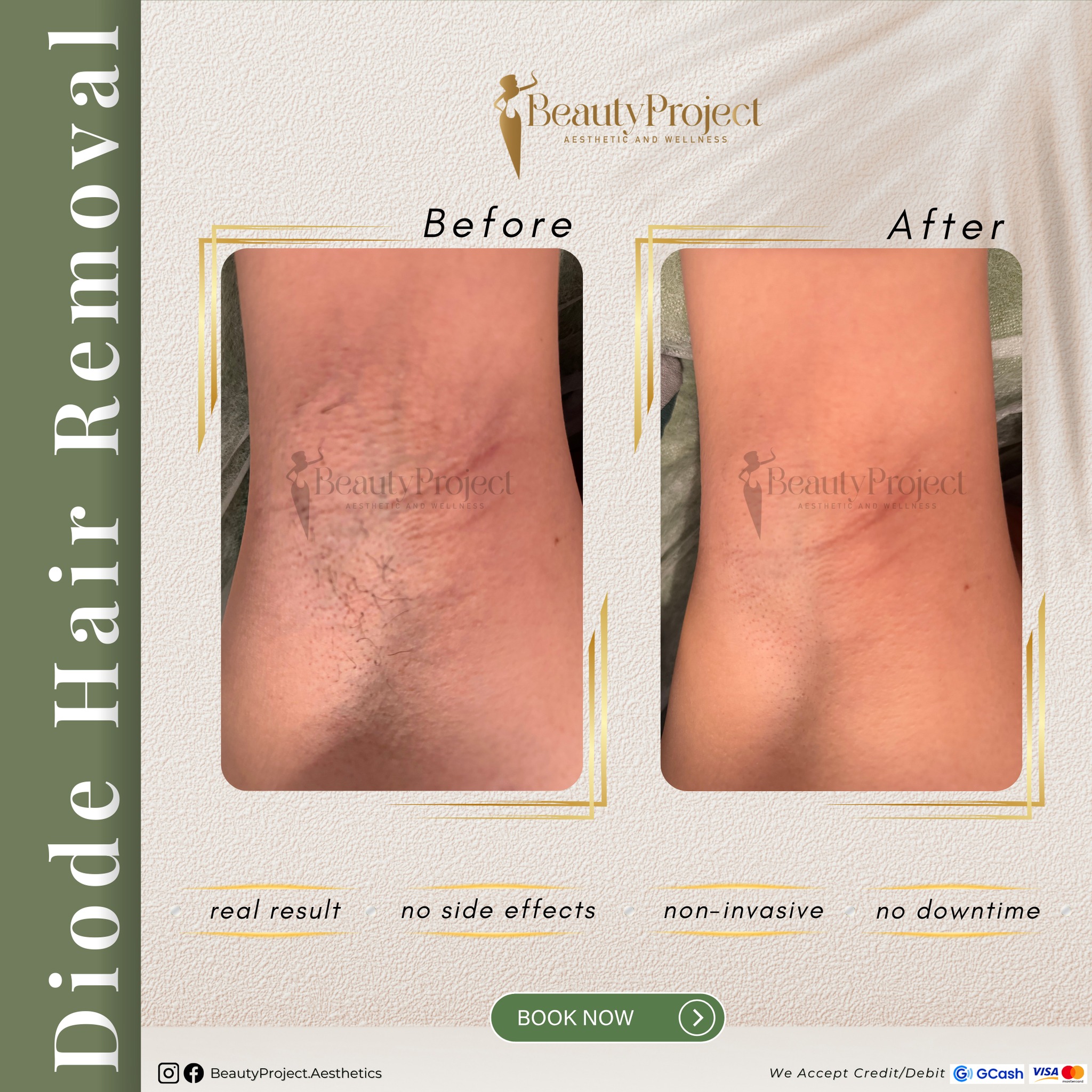 BeautyProject - Sto. Tomas, Batangas Facebook ad: 𝗖𝗼𝗻𝘀𝘁𝗮𝗻𝘁 𝘀𝗵𝗮𝘃𝗶𝗻𝗴 𝗮𝗻𝗱 𝘄𝗮𝘅𝗶𝗻𝗴?