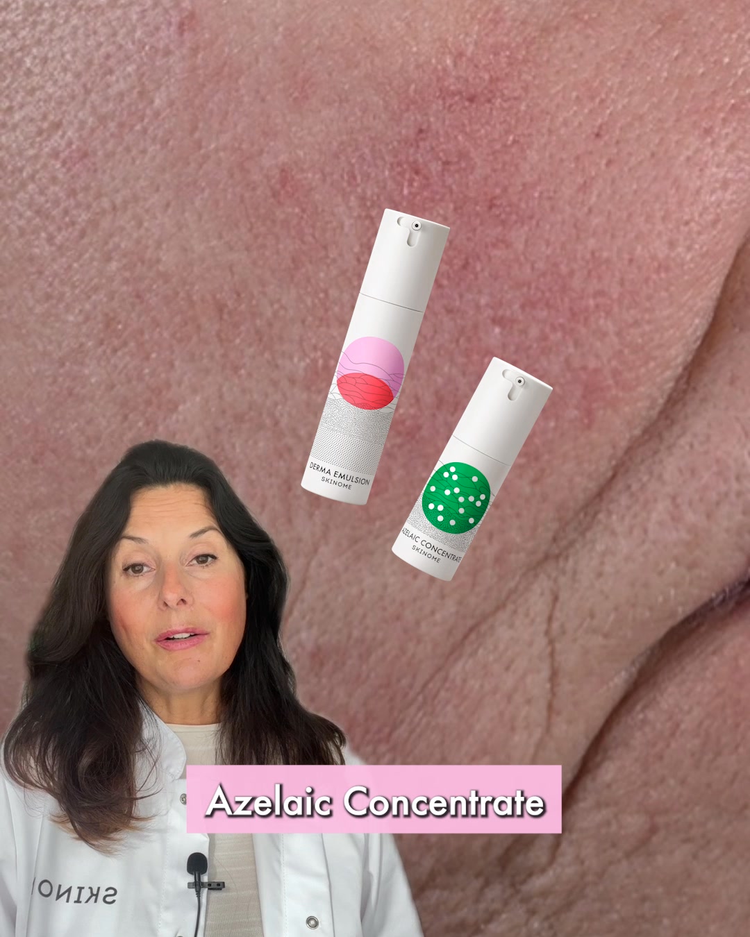 Skinome Facebook ad from Aug 13, 2026