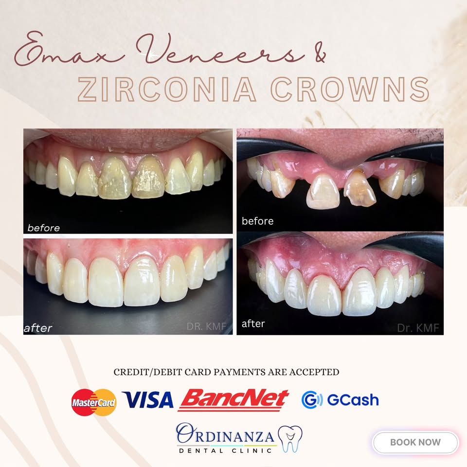 Ordinanza Dental Clinic Facebook ad: Achieve the smile of your dreams with our…