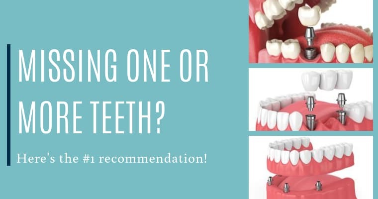 Copperopolis Dental Facebook ad: Free Consultations