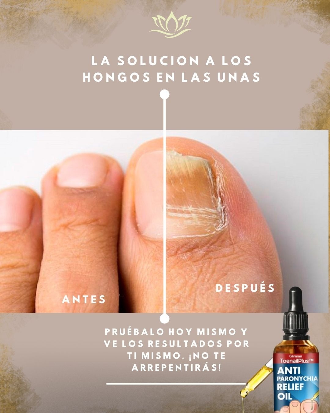 Productos de belleza Facebook ad: ¡Adiós a los hongos en tus uñas!