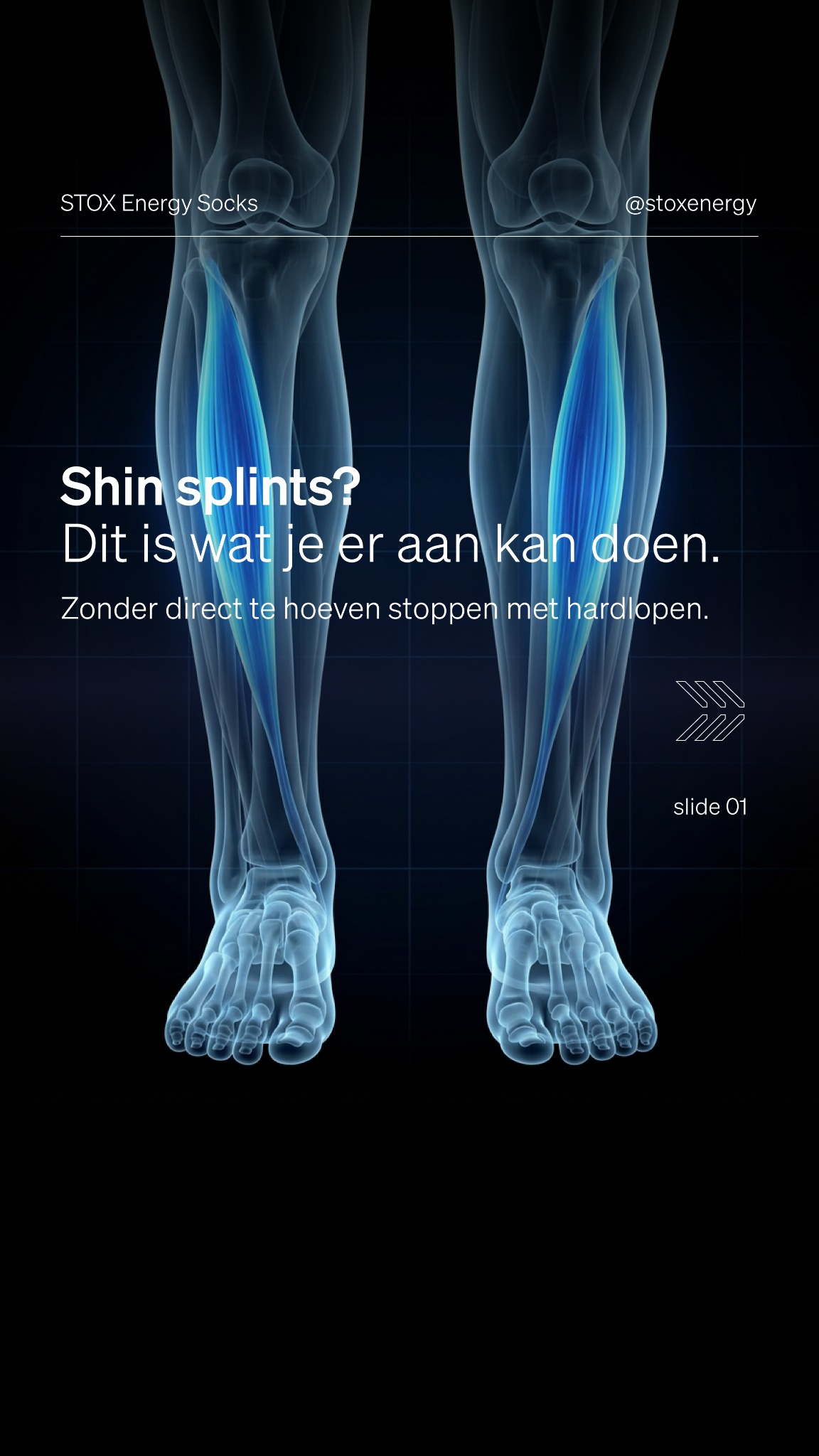 STOX Energy Socks Facebook ad: Voorkom blessures en spierpijn met STOX Energy Socks.